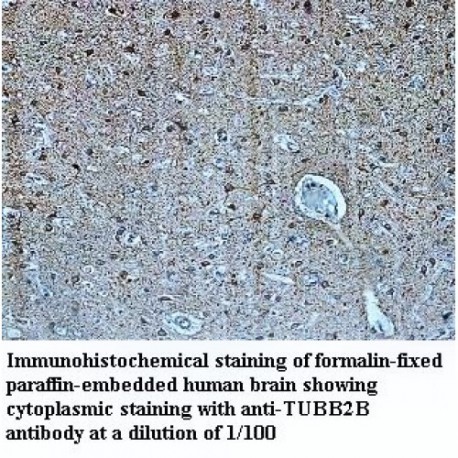 TUBB2B Antibody