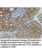 TTPA Antibody