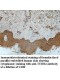 TUBB4 Antibody