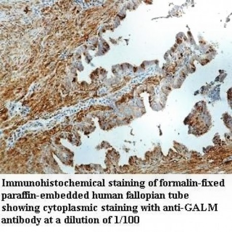 GALM Antibody