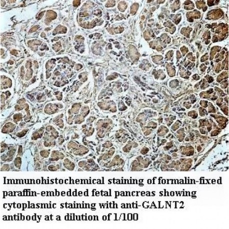 GALNT2 Antibody