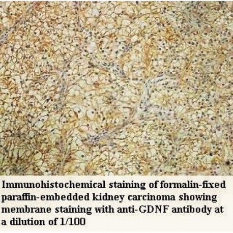 GDNF Antibody