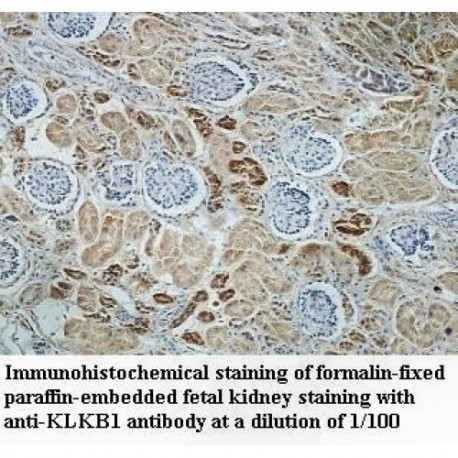 KLKB1 Antibody