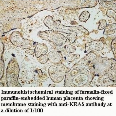 KRAS Antibody