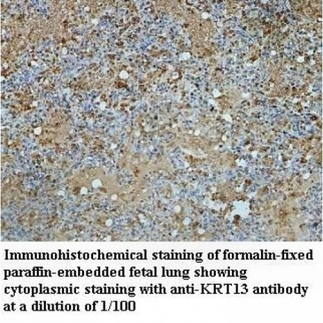 KRT13 Antibody