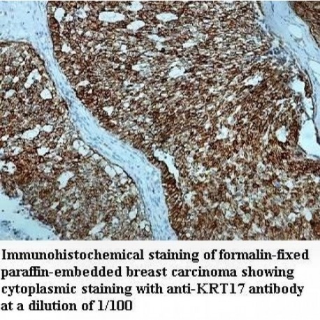 KRT17 Antibody