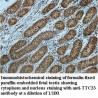 TTC33 Antibody