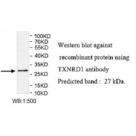 TXNRD1 Antibody