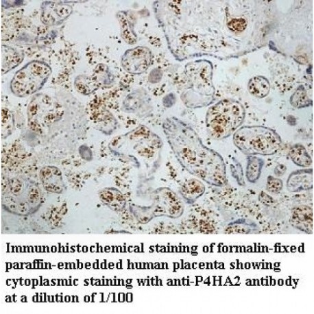 P4HA2 Antibody