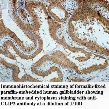 CLIP3 Antibody