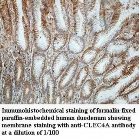 CLEC4A Antibody