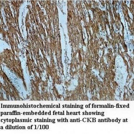 CKB Antibody