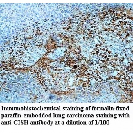 CISH Antibody