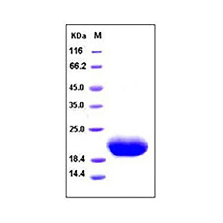 Human IL6/Interleukin-6 Protein