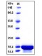 Human Interleukin-21 / IL-21 Protein