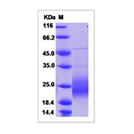 Human GM-CSF / CSF2 Protein