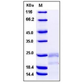Human IFN-gamma / IFNG / γ-IFN Protein