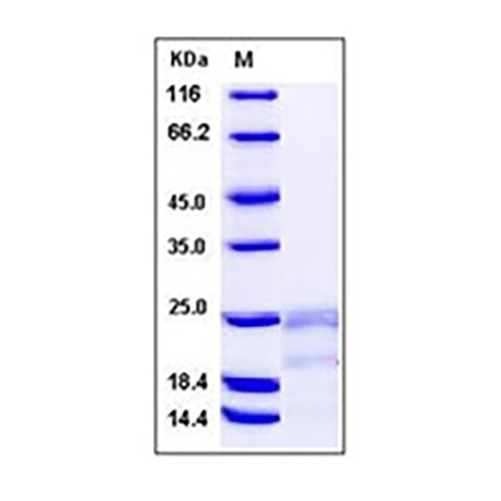 Human IFN-gamma / IFNG / γ-IFN Protein