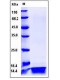 Human IL4 / Interleukin-4 Protein