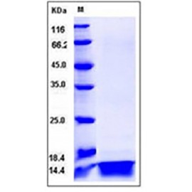 Human IL4 / Interleukin-4 Protein