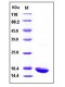 Human IL-1 beta / IL 1B Protein