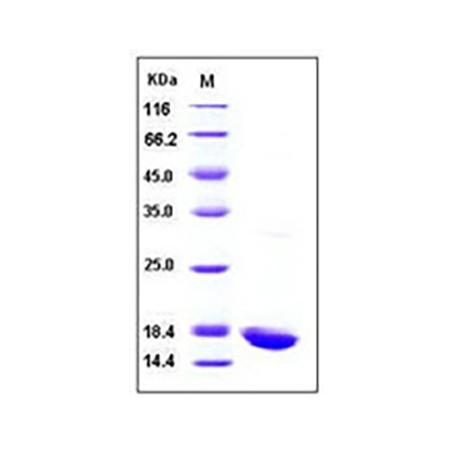 Human IL-1 beta / IL 1B Protein