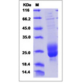 Human M-CSF / CSF-1 Protein
