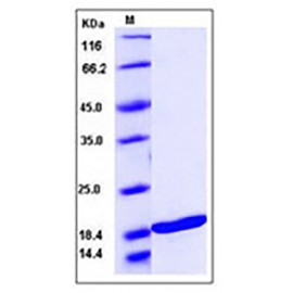 Human TNFSF10 / TRAIL / APO-2L / CD253 Protein