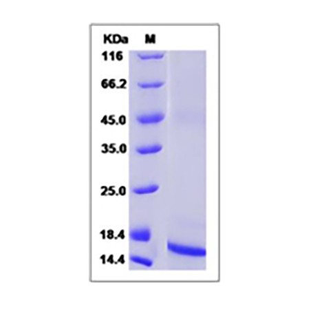 Rat / Mouse TGF-beta 1 / TGFB1 Protein