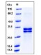Human HMGB1 / HMG1 Protein (His Tag)
