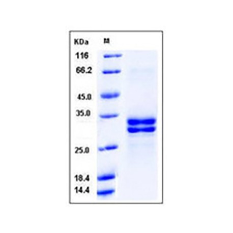 Human HMGB1 / HMG1 Protein (His Tag)