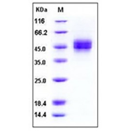 Human MICB Protein (His Tag)