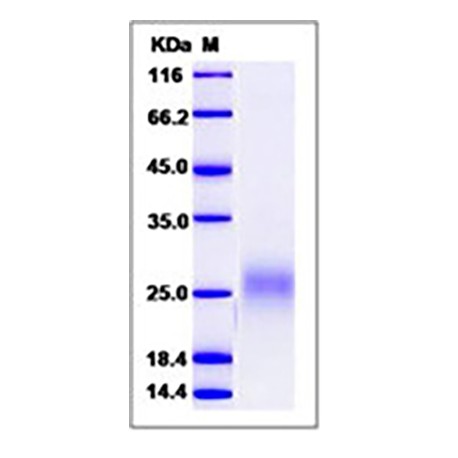 Human FLT3L / Flt3 ligand / FLT3LG Protein (His Tag)