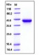 Human IL2Ra / CD25 Protein (His Tag)