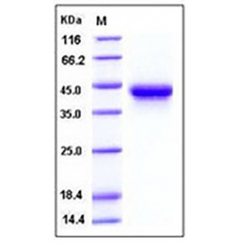 Human IL2Ra / CD25 Protein (His Tag)