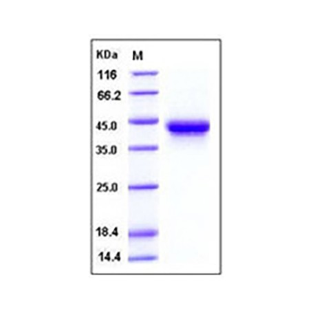 Human IL2Ra / CD25 Protein (His Tag)