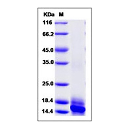 Human IL-15 / IL15 / Interleukin 15 Protein (His Tag)