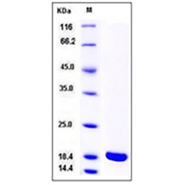 Rat IL-1 beta / IL1B Protein (mature form)