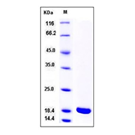 Rat IL-1 beta / IL1B Protein (mature form)