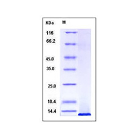 Human IGF1 / IGF-I Protein