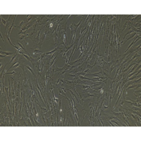 Human Primary Coronary Artery Endothelial Cells