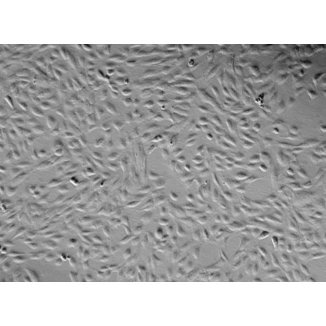 Human Primary Pulmonary Artery Endothelial Cells