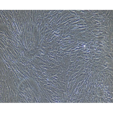 Human Primary Esophageal Fibroblasts Cells