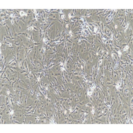 Human Primary Ureteral Epithelial Cells