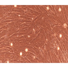 Human Primary Ureteral Smooth Muscle Cells