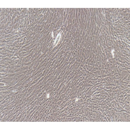 Human Primary Bladder Smooth Muscle Cells supplier