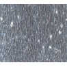 Human Primary Bladder Fibroblasts Cells