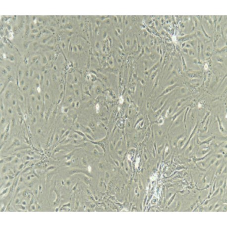 Human Primary Thyroid Epithelial Cells