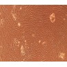 Human Primary Thyroid Fibroblasts Cells