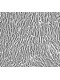 Human Primary Prostatic Fibroblasts Cells